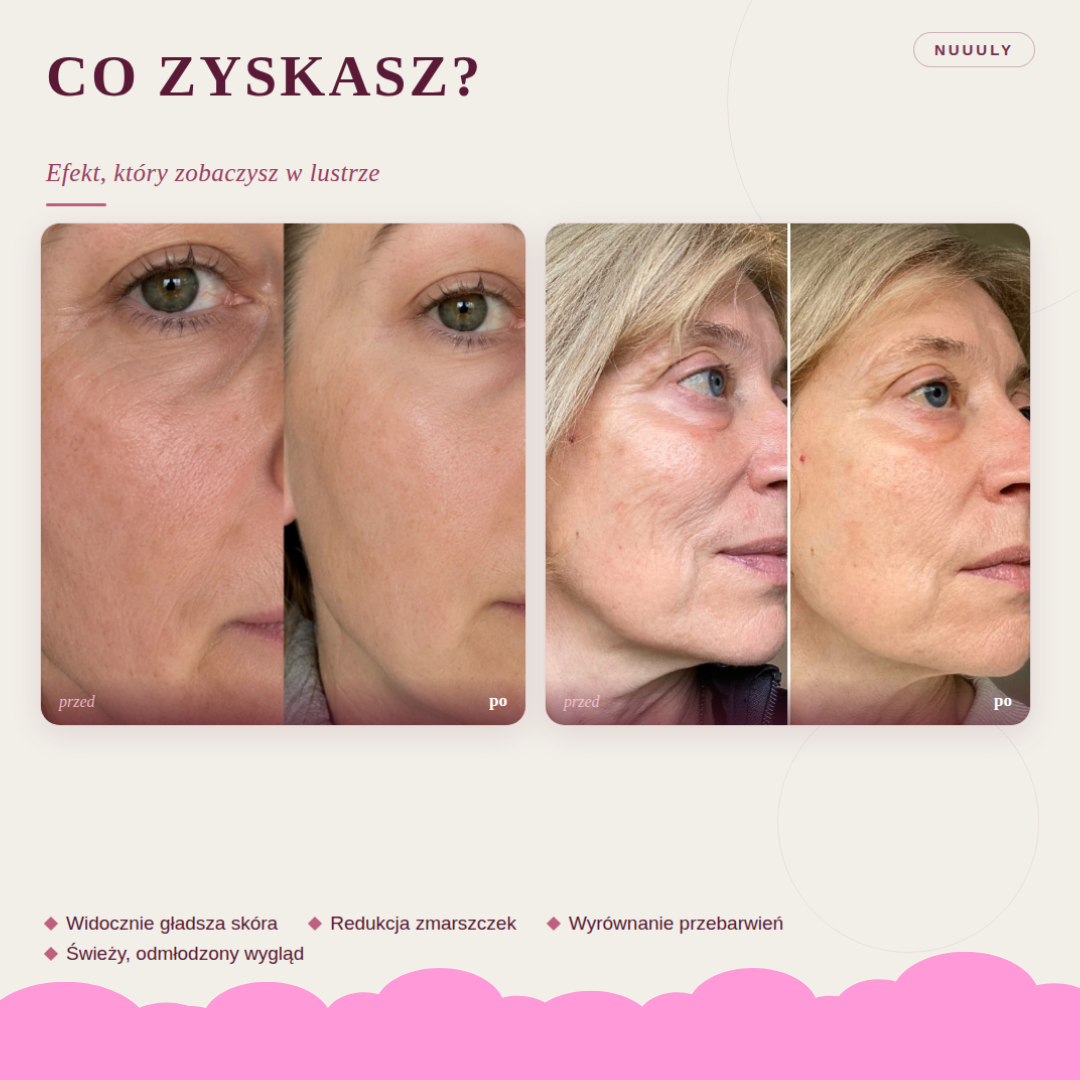 Maska LED Lumio - Codzienny kwadrans dla Twojej skóry