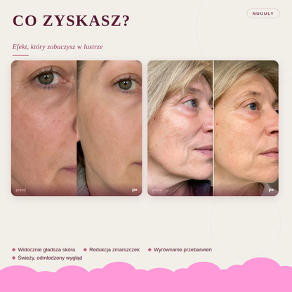 Maska LED Lumio - Codzienny kwadrans dla Twojej skóry