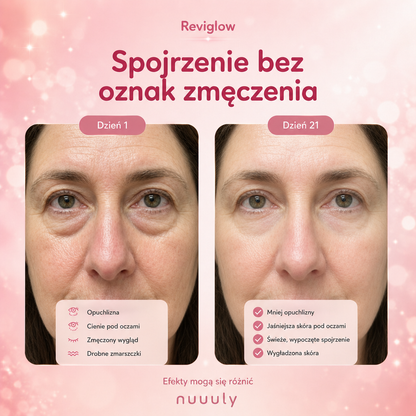 Reviglow – Masażer pod oczy z czerwonym światłem i EMS · 10 minut spa dla spojrzenia